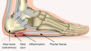 Effects of High-Intensity Circuit Training on Calcaneal Bone Status in Collegiate Women